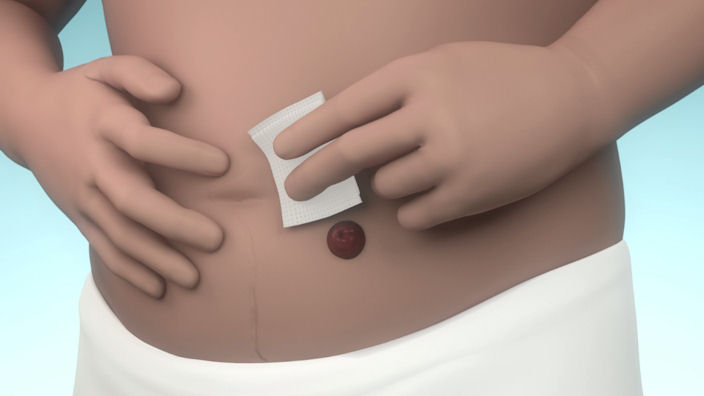 Comment utiliser les lingettes de protection cutanée Brava ?